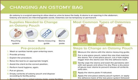 How much fluid should you consume in a day with an ostomy bag?